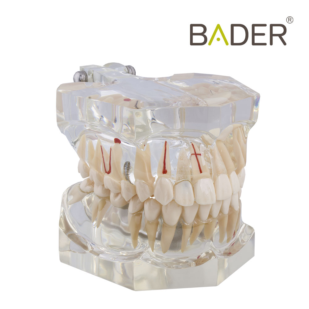 MACROMODEL WITH COMPLETE PATHOLOGY